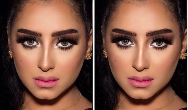 بالفيديو.. المهرة البحرينية تخضع لعملية تجميل نادرة