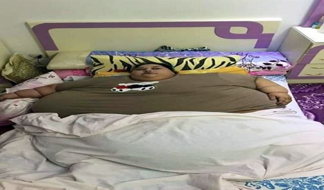 بالصور.. امرأة مصرية وزنها نصف طن