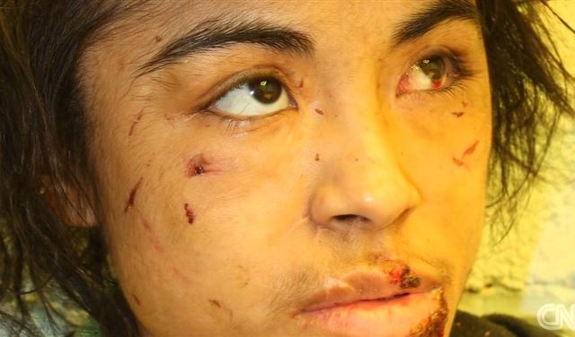 نجت بحياتها بعد 5سنوات من العبودية والضرب والتعذيب
