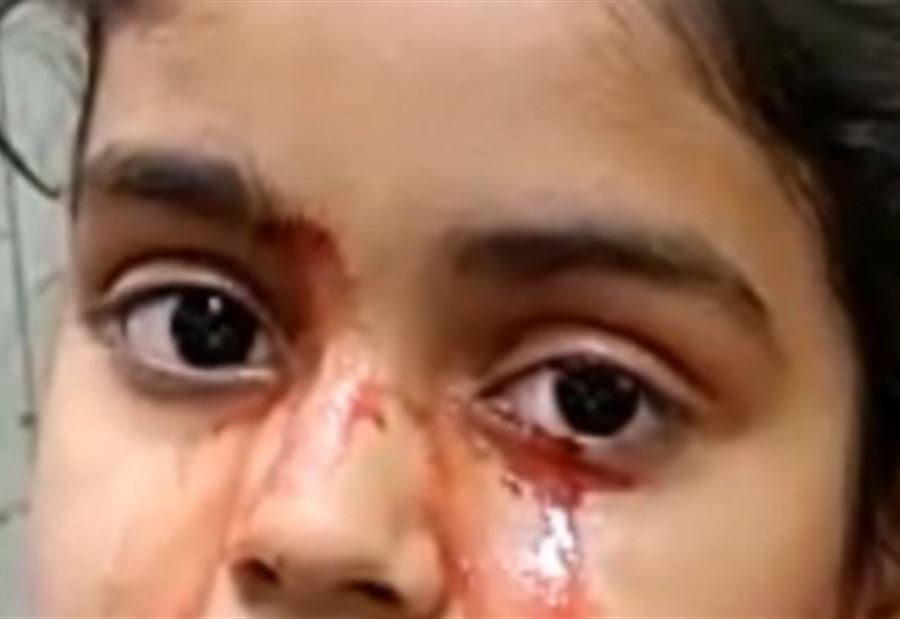 حالة طبية نادرة تُرْبِك الأطباء!