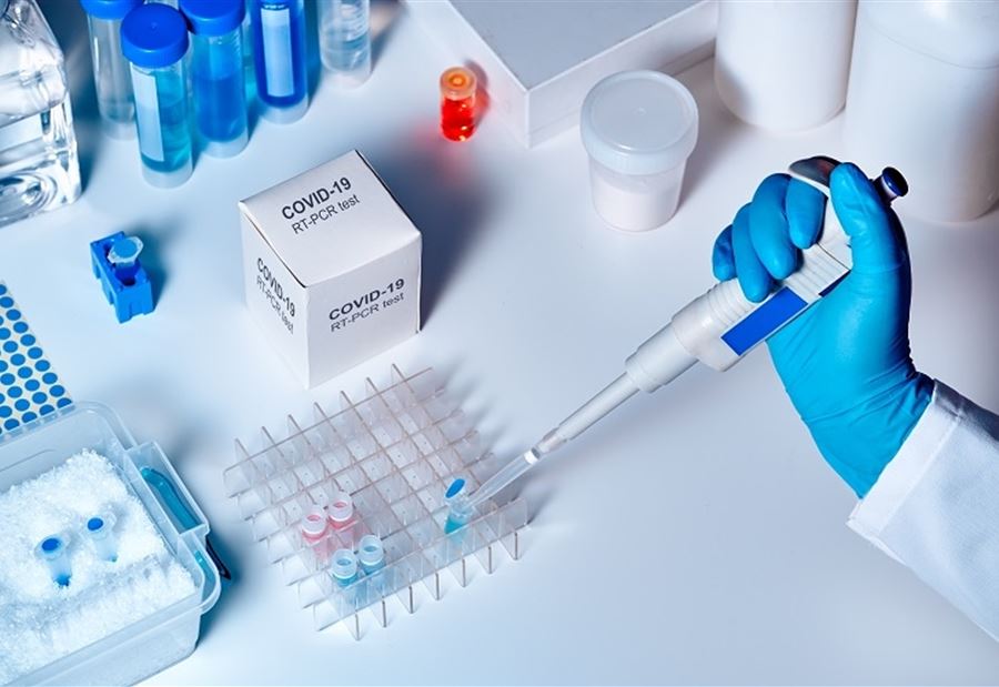نتائجُ فحوص "PCR" لمواطنين حاولوا التوجّه إلى قبرص