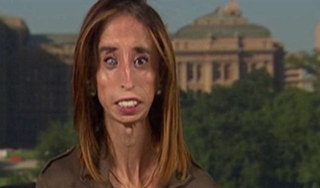 بالصور: وصفوها بـ"أقبح امرأة بالعالم".. وهكذا ردت عليهم!