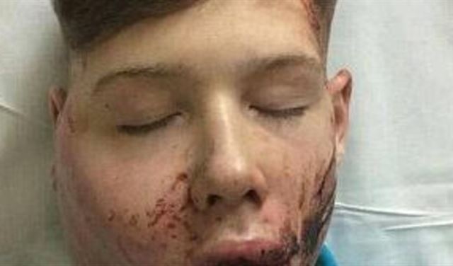 صور صادمة.. هكذا سقط صبي ضحية "التنمر المدرسي"