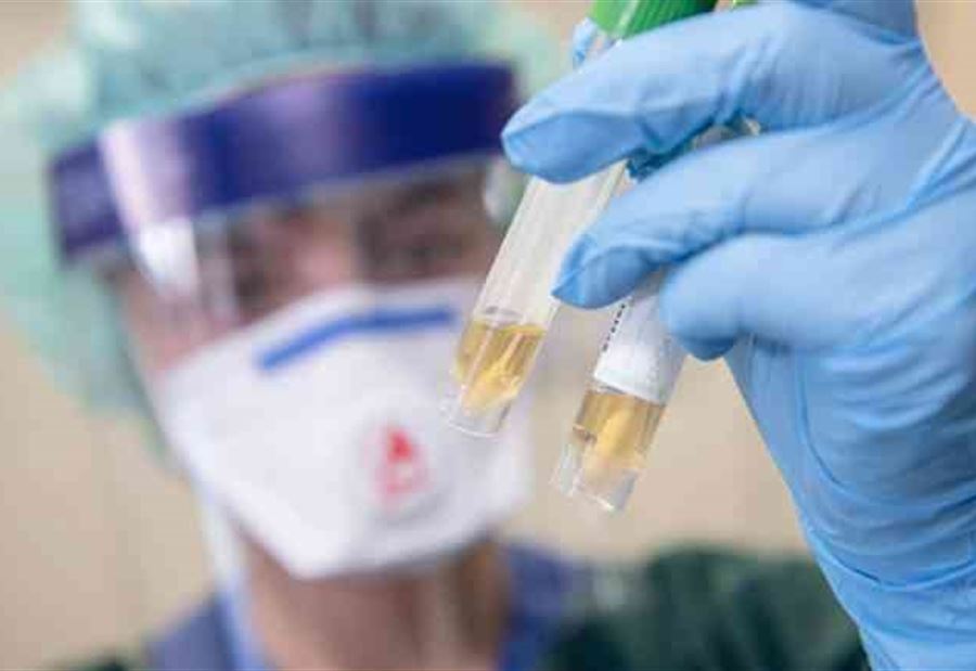 "إنزيم التمويه"... علماء يكشفون "حيلة" الإصابة بكورونا "إنزيم التمويه"... علماء يكشفون "حيلة" الإصابة بكورونا