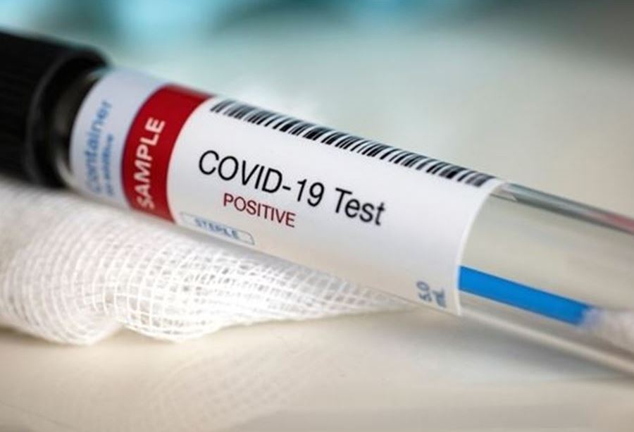 إليكُم إصابات ووفيات كورونا الجديدة في لبنان!