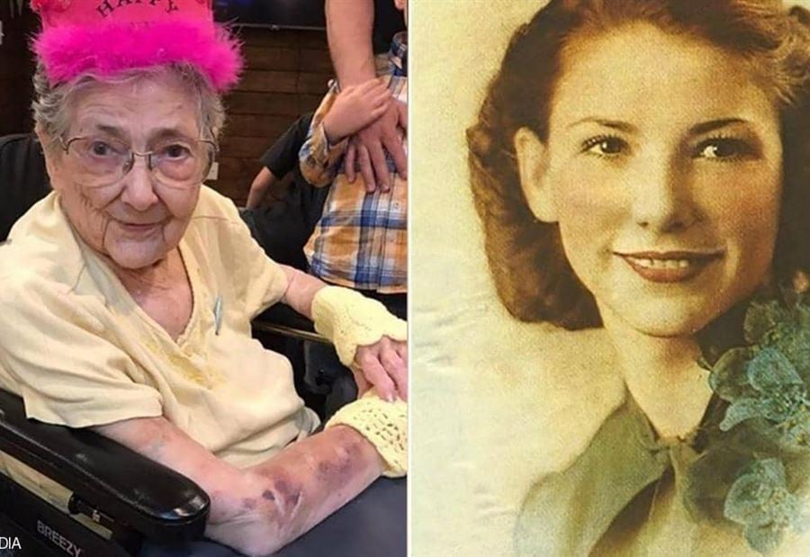 عاشت 99 عاما وأعضاؤها في الأماكن الخطأ