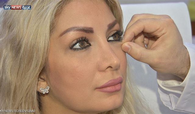 انتفاخ العينين.. الأسباب والعلاج