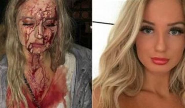 صور مروعة.. رفضت التحرش فهشم وجهها "الفاتن" وأدماه