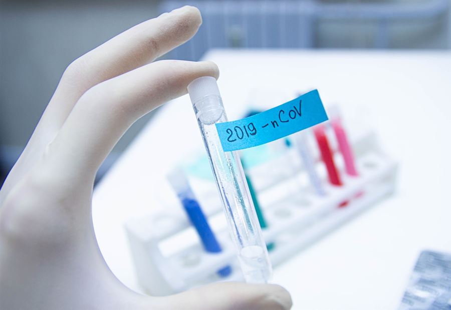 نتائج فحوص "كورونا" لمخالطي الممثل وجيه صقر نتائج فحوص "كورونا" لمخالطي الممثل وجيه صقر