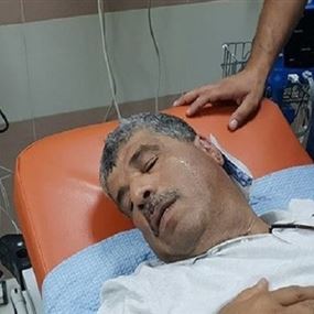 بالصورة: إصابة وزير فلسطيني برصاصة مطاطية