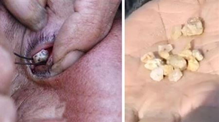 صينية تبكي حجارة بدلا من الدموع
