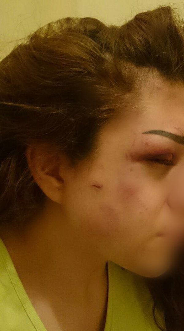 بالصور.. احتجز زوجته وعنّفها وهدّدها بالقتل في الاوزاعي