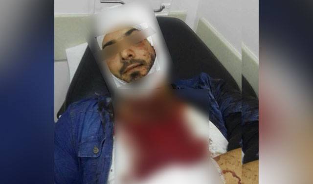 بالصورة.. الجريح في إنفجار فردان