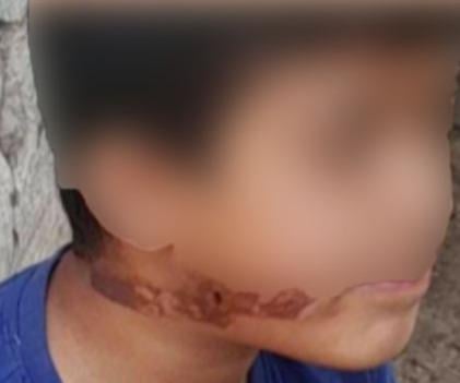 "قتل ابنته"... أب يعنّف أبناءه بِطرق وحشية في البقاع (صور)