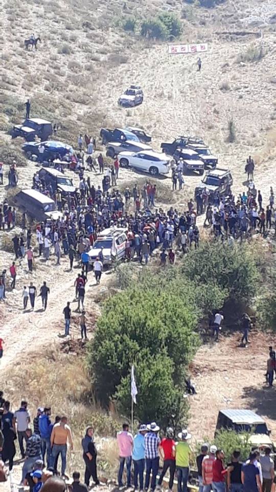 بالصور: إصابة فتاة نتيجة لكمة من حصان في الضنية