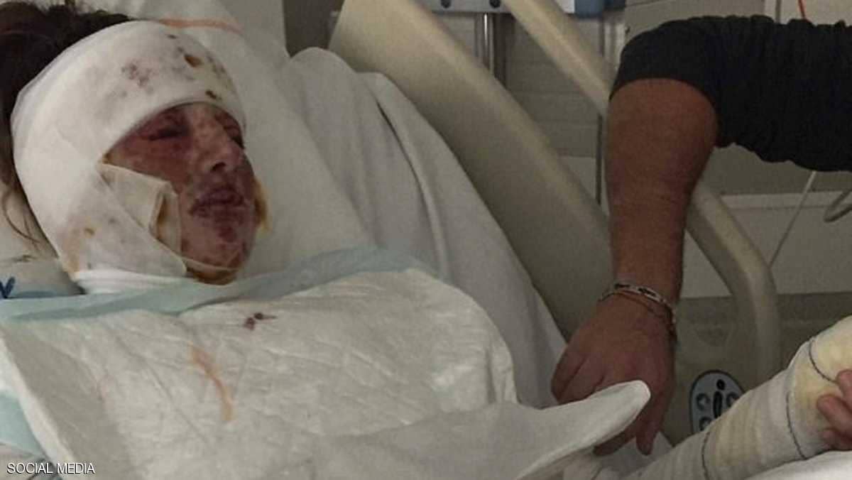 بالصورة:  جرعة "بنسلين" تحول حياة شابة فرنسية إلى "جحيم"