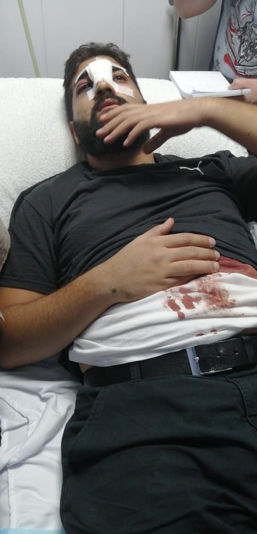 استياء في زحلة بعد محاولة قتل "داني التن"